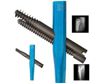 img-F-01-TrigenIntertan